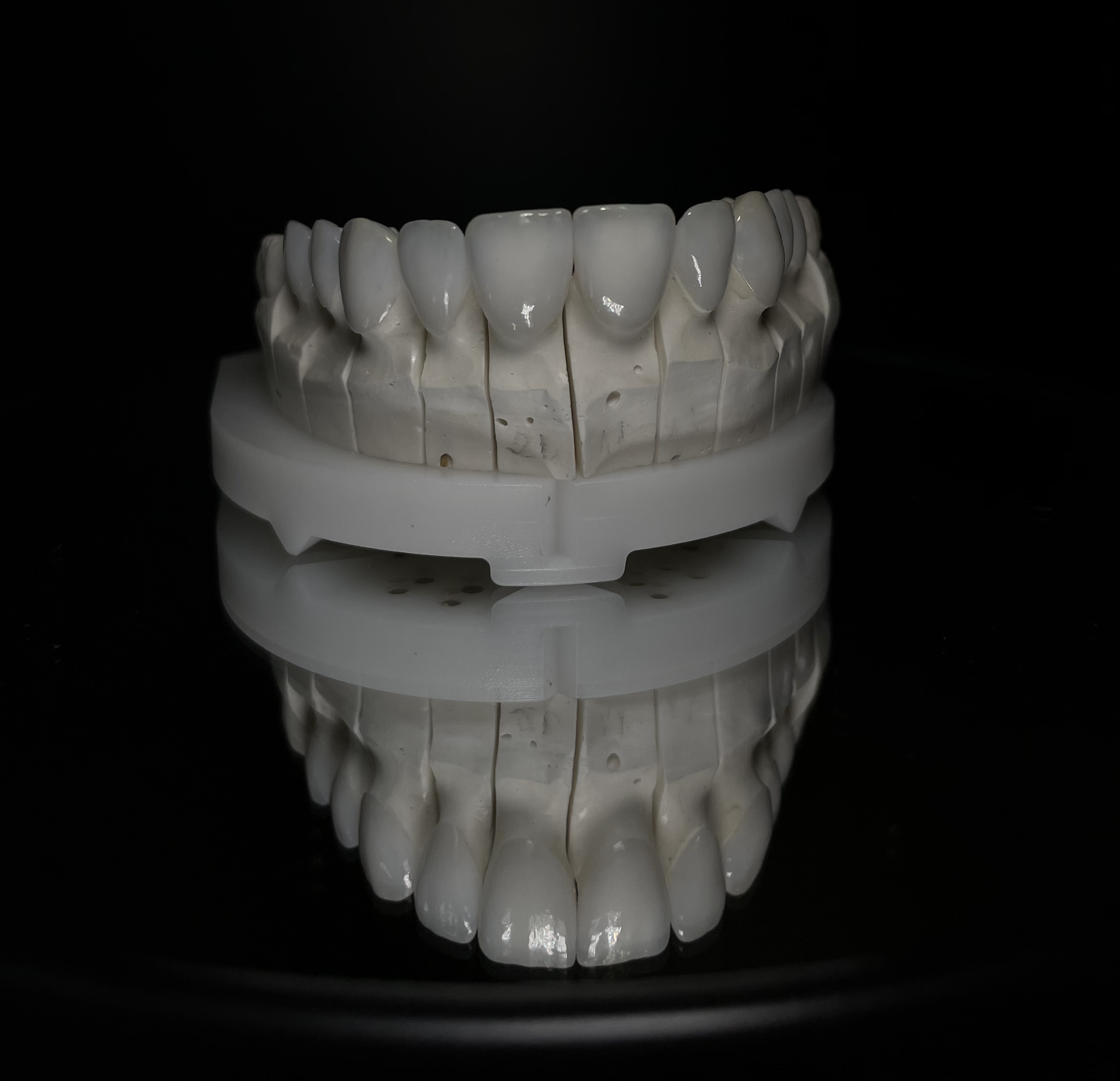Modelo de arcada dentária demonstrando lentes de contato dental em fundo escuro